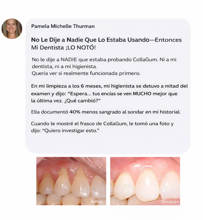 Luniva – Colla Gum