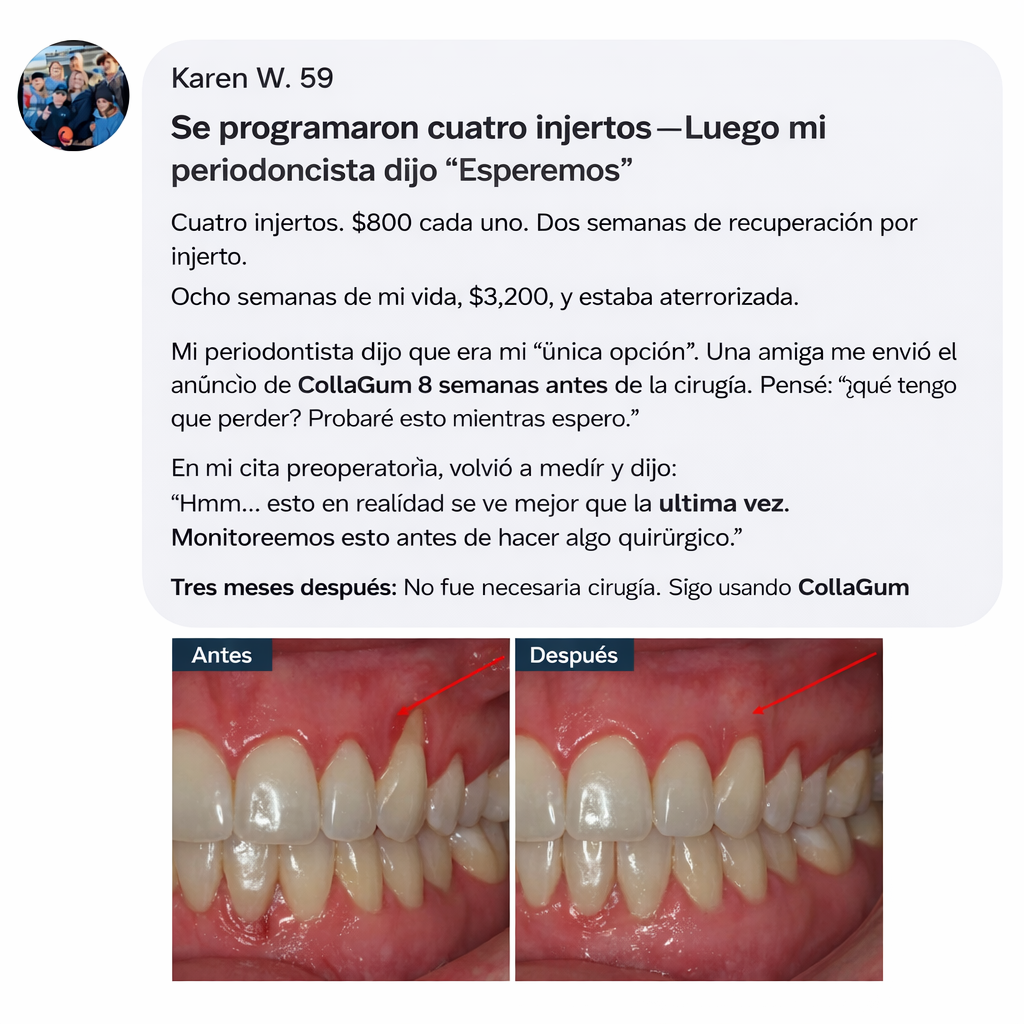 Luniva – Colla Gum