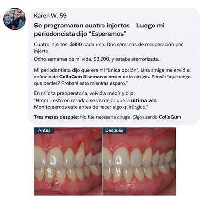 Luniva – Colla Gum