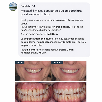 Luniva – Colla Gum